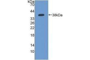 Detection of Recombinant IFI35, Human using Polyclonal Antibody to Interferon Inducible Protein 35 (IFI35) (IFI35 antibody  (AA 2-286))