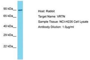 Image no. 1 for anti-Vertebrae Development Associated (VRTN) (AA 568-617) antibody (ABIN6750624) (VRTN antibody  (AA 568-617))