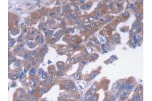 Immunohistochemistry (IHC) image for anti-alpha-2-Macroglobulin (A2M) (AA 616-856) antibody (ABIN7426145)