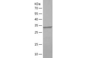 Western Blotting (WB) image for Insulin Receptor Substrate 2 (IRS2) (AA 1035-1136) protein (His-IF2DI Tag) (ABIN7283948) (IRS2 Protein (AA 1035-1136) (His-IF2DI Tag))