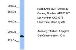 Image no. 1 for anti-Survival of Motor Neuron 1, Telomeric (SMN1) (C-Term) antibody (ABIN6749972) (SMN1 antibody  (C-Term))