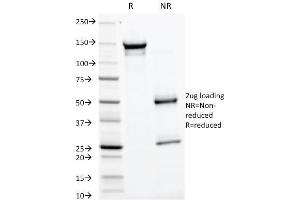 SDS-PAGE Analysis Purified GP2 Mouse Monoclonal Antibody (GP2/1805). (GP2 antibody  (AA 35-179))