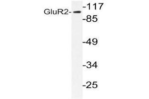 Western blot analysis of GluR2 antibody in extracts from HUVEC cells.