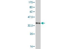Western Blot detection against Immunogen (36. (ABL2 antibody  (AA 743-842))