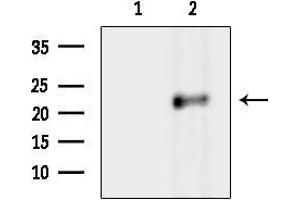 anti-Phospholipase A2, Group XIIB (PLA2G12B) antibody