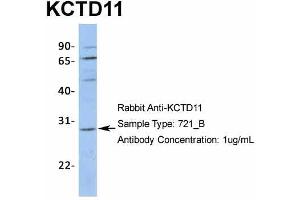 Host:  Rabbit  Target Name:  KCTD11  Sample Type:  721_B  Antibody Dilution:  1. (KCTD11 antibody  (N-Term))
