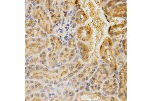 Immunohistochemistry of paraffin-embedded mouse kidney using ACADM antibody at dilution of 1:200 (x400 lens) (Medium-Chain Specific Acyl-CoA Dehydrogenase, Mitochondrial (AA 1-220) antibody)