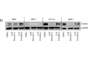 Western Blotting (WB) image for anti-Glyceraldehyde-3-Phosphate Dehydrogenase (GAPDH) antibody (ABIN2857072)