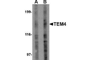 Western Blotting (WB) image for anti-rho Guanine Nucleotide Exchange Factor (GEF) 17 (ARHGEF17) (Middle Region) antibody (ABIN1031118) (ARHGEF17 antibody  (Middle Region))