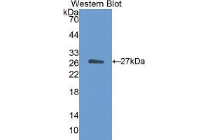 Western blot analysis of the recombinant protein. (CETP antibody  (AA 81-311))