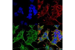 Immunocytochemistry/Immunofluorescence analysis using Mouse Anti-GluN2A/NR2A Monoclonal Antibody, Clone S327-95 . (NMDAR2A antibody  (AA 75-325))