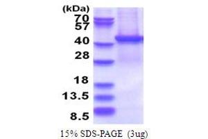 SDS-PAGE (SDS) image for Proteasome (Prosome, Macropain) 26S Subunit, Non-ATPase, 13 (PSMD13) (AA 1-376) protein (His tag) (ABIN5853736)