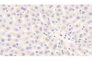Detection of NOX3 in Rat Liver Tissue using Polyclonal Antibody to Nicotinamide Adenine Dinucleotide Phosphate Oxidase 3 (NOX3) (NOX3 antibody  (AA 221-466))