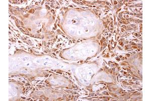 IHC-P Image ITPase antibody [N1C3] detects ITPase protein at cytosol on Ca922 xenograft by immunohistochemical analysis. (ITPA antibody)