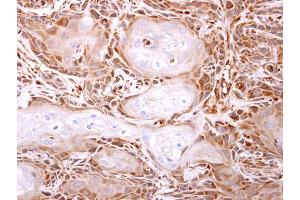 IHC-P Image ITPase antibody [N1C3] detects ITPase protein at cytosol on Ca922 xenograft by immunohistochemical analysis.