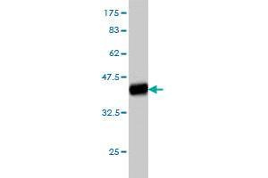 Western Blot detection against Immunogen (37. (ITGA4 antibody  (AA 98-207))