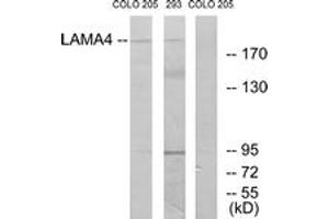 Western blot analysis of extracts from COLO/293 cells, using LAMA4 Antibody. (LAMa4 antibody  (AA 481-530))