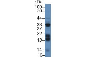 Detection of IGFBP3 in Mouse Liver lysate using Polyclonal Antibody to Insulin Like Growth Factor Binding Protein 3 (IGFBP3) (IGFBP3 antibody  (AA 106-241))