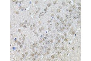Immunohistochemistry of paraffin-embedded Mouse brain using DR1 Polyclonal Antibody at dilution of 1:100 (40x lens). (DR1 antibody)