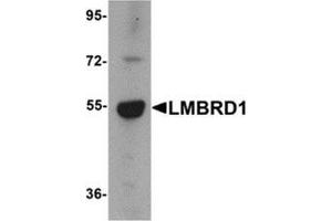 Western blot analysis of LMBRD1 in human brain tissue lysate with LMBRD1 antibody at 1 μg/ml. (LMBRD1 antibody  (C-Term))