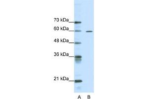WB Suggested Anti-ARID3A Antibody Titration:  0. (ARID3A antibody  (Middle Region))