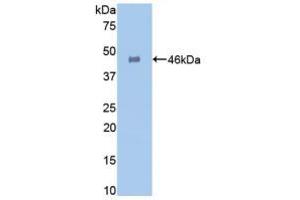 WB of Protein Standard: different control antibodies against Highly purified E. (GLA ELISA Kit)
