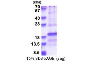 SDS-PAGE (SDS) image for Ribosomal Protein L31 (RPL31) (AA 1-125) protein (His tag) (ABIN6387333) (RPL31 Protein (AA 1-125) (His tag))