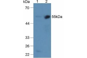 Western blot analysis of (1) Mouse Liver Tissue and (2) Mouse Kidney Tissue. (alpha 2 Antiplasmin antibody  (AA 340-491))
