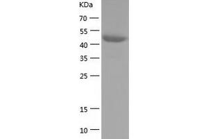 Western Blotting (WB) image for Pancreatic Lipase (PNLIP) (AA 17-465) protein (His tag) (ABIN7124304) (PNLIP Protein (AA 17-465) (His tag))