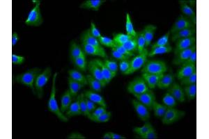 Immunofluorescence staining of HepG2 cells with ABIN7167772 at 1:266, counter-stained with DAPI.