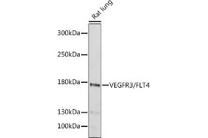Western blot analysis of extracts of Rat lung, using VEGFR3/FLT4 antibody (ABIN6130779, ABIN6140698, ABIN6140701 and ABIN6217251) at 1:1000 dilution. (FLT4 antibody  (AA 1174-1363))