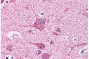 Human Brain, Cortex: Formalin-Fixed, Paraffin-Embedded (FFPE) (RORC antibody  (AA 110-159))