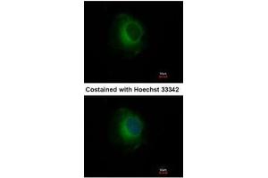 ICC/IF Image Immunofluorescence analysis of methanol-fixed HeLa, using Plasminogen, antibody at 1:500 dilution. (PLG antibody)