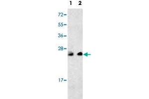 Western blot analysis of multiple cells cell lysate (35 ug/lane) with PTP4A3 polyclonal antibody .