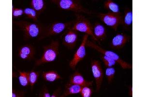 IF analysis of Alpha B Crystallin/CRYAB using anti-Alpha B Crystallin/CRYAB antibody (ABIN7601209). (CRYAB antibody  (AA 30-151))