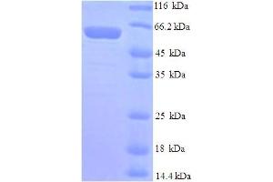 SDS-PAGE (SDS) image for Mdm2, p53 E3 Ubiquitin Protein Ligase Homolog (Mouse) (MDM2) (AA 1-489), (full length) protein (His tag) (ABIN5709925)