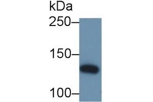 Detection of IRS1 in Bovine Cerebrum lysate using Polyclonal Antibody to Insulin Receptor Substrate 1 (IRS1) (IRS1 antibody  (AA 837-1089))