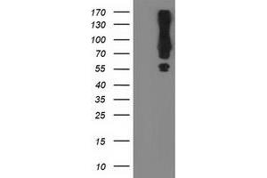 HEK293T cells were transfected with the pCMV6-ENTRY control (Left lane) or pCMV6-ENTRY MGRN1 (Right lane) cDNA for 48 hrs and lysed. (Mahogunin RING Finger Protein 1 antibody)