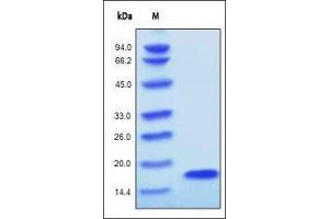 Human FGF acidic, Tag Free on SDS-PAGE under reducing (R) condition. (FGF acidic (AA 16-155) Protein)