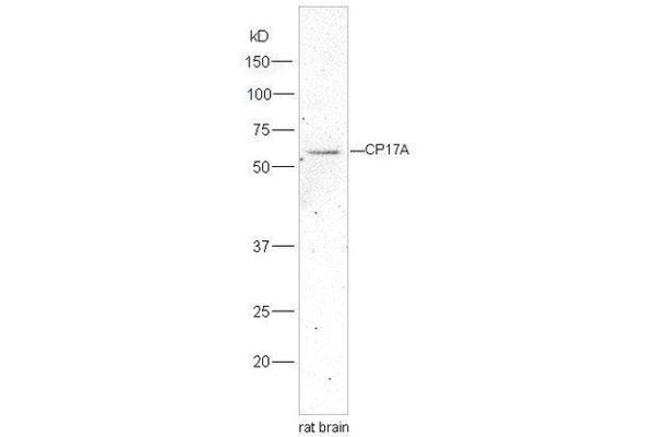 CYP17A1 antibody  (AA 24-65)