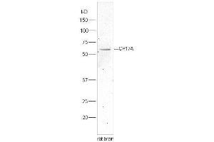 Lane 1:rat brain lysates probed with Rabbit Anti-Cytochrome P450 17A1 Polyclonal Antibody, Unconjugated  at 1:5000 for 90 min at 37˚C. (CYP17A1 antibody  (AA 24-65))