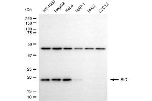 Western blotting analysis using BID antibody (ABIN7797767).