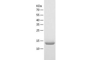 Western Blotting (WB) image for Thioredoxin-Like 4B (TXNL4B) (AA 1-149) protein (His tag) (ABIN7125367)