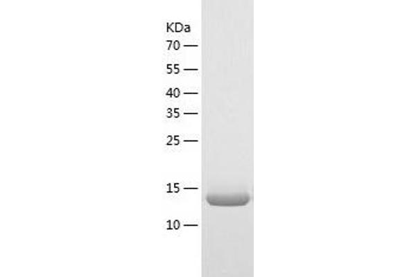 TXNL4B Protein (AA 1-149) (His tag)