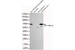 Western blot detection of Human Serum Albumin in 0. (HSA antibody)