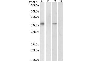 Western Blotting (WB) image for anti-Retinoid X Receptor, alpha (RXRA) (AA 14-28) antibody (ABIN185295)