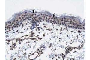Image no. 1 for anti-RNA Polymerase II TBP-Associated Factor Subunit G (TAF9) (AA 25-74) antibody (ABIN6735958) (TAF9 antibody  (AA 25-74))