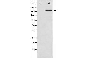 Western blot analysis of Ret expression in K562 whole cell lysates,The lane on the left is treated with the antigen-specific peptide. (Ret Proto-Oncogene antibody  (C-Term))