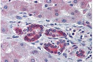 Immunohistochemistry (Paraffin-embedded Sections) (IHC (p)) image for anti-T-Cell Acute Lymphocytic Leukemia 1 (TAL1) (C-Term) antibody (ABIN6741621)