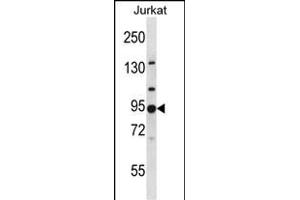 AP1G2 anticorps  (N-Term)